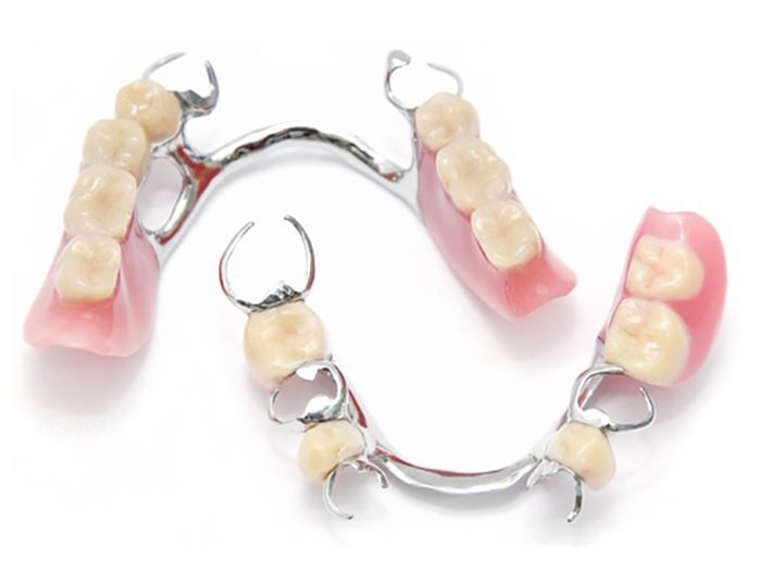 Partial Dentures